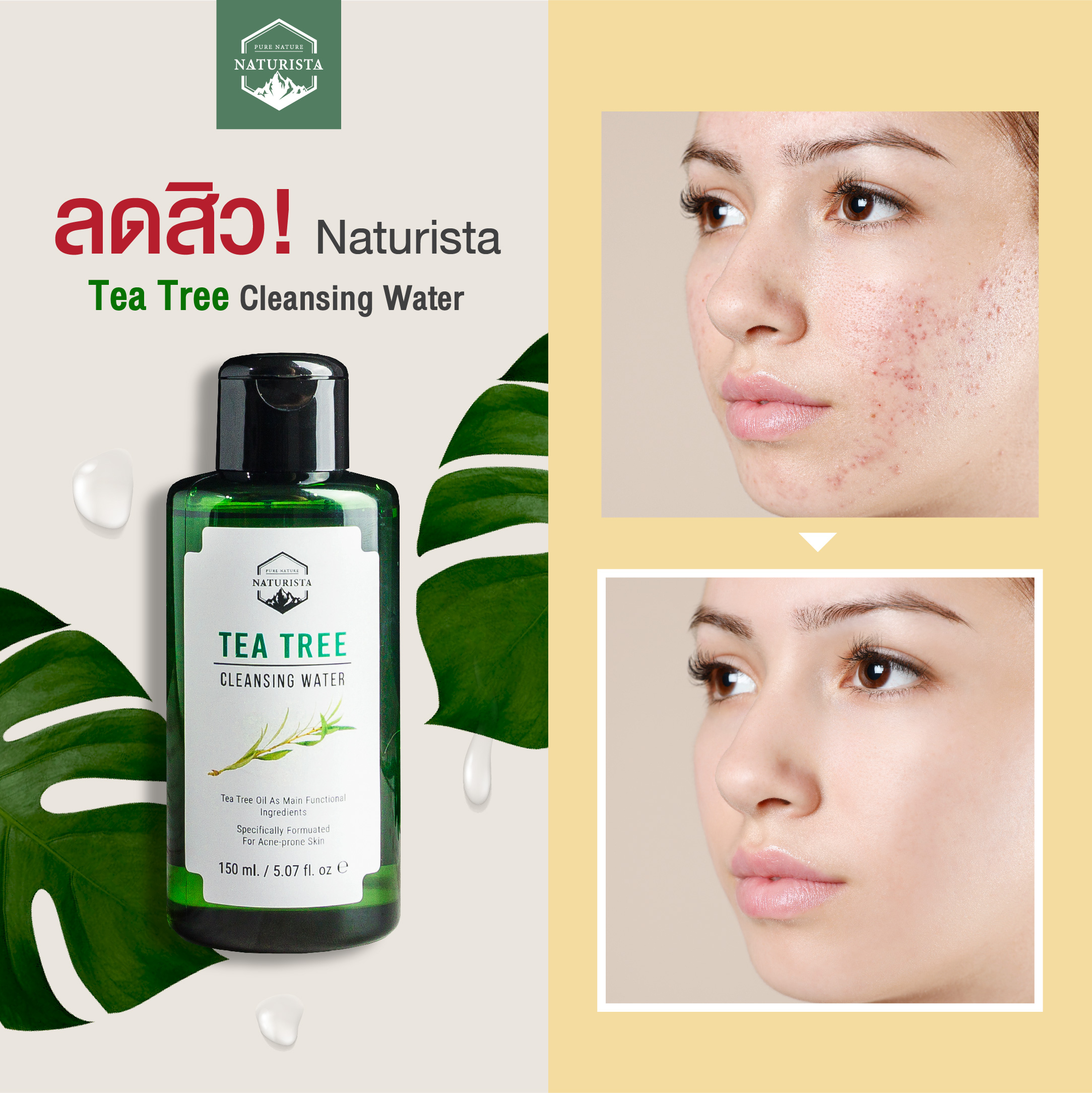 Naturista Tree Cleansing Water  ✓ Clinically Tested   ✓ Alcohol Free   ✓ Preservative Free   ✓ ECOCERT Organic    ปราศจากแอลกอฮอลล์ หากลูกค้าใช้แล้วรู้สึกเย็น เป็น Characteristic ของ Tea Tree Essential Oil  Tea Tree Essential Oil มีกลิ่นเฉพาะตัวที่ค่อนข้างฉุน ในสูตรจึงมีความจำเป็นที่ต้องมีน้ำหอมเกรดพิเศษ Allergen Free (ไม่ก่อให้เกิดการแพ้) ในปริมาณน้อยมาก เพื่อช่วยตัดกลิ่น Tea Tree ไม่ให้รู้สึกฉุนเกินไป โดยคนที่แพ้น้ำหอมในครีมอื่นๆ สามารถใช้ได้ค่ะ เนื่องจากมีความอ่อนโยนสูง
